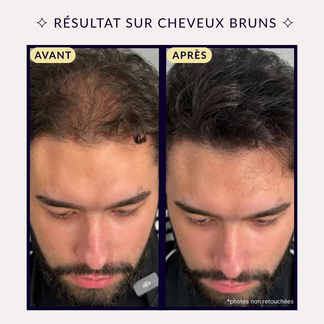 Crème BoostHair™ – Soin Densifiant & Correcteur Capillaire