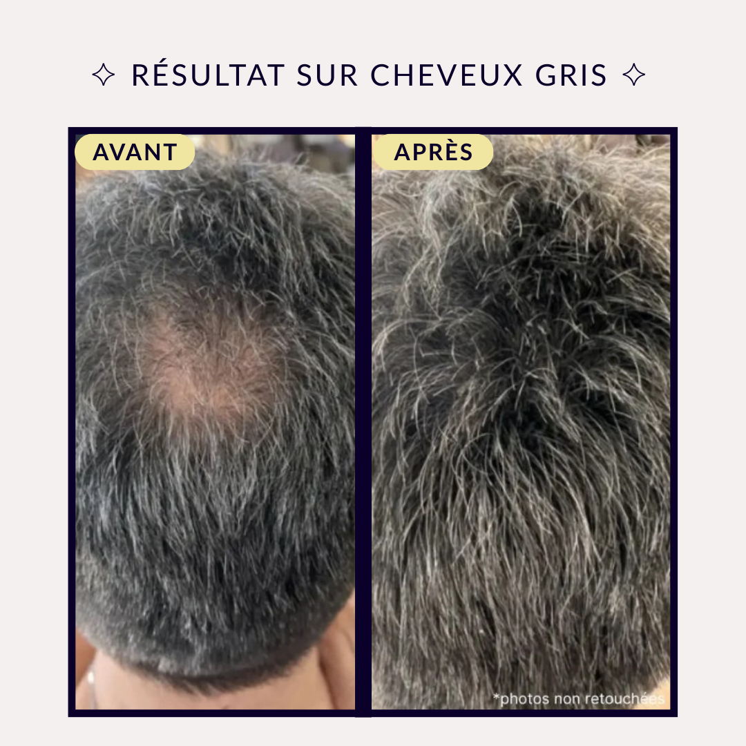 Crème BoostHair™ – Soin Densifiant & Correcteur Capillaire