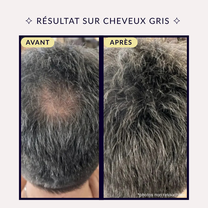 Crème BoostHair™ – Soin Densifiant & Correcteur Capillaire