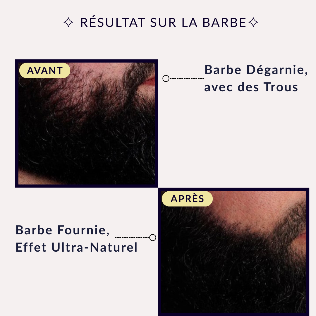 Crème BoostHair™ – Soin Densifiant & Correcteur Capillaire